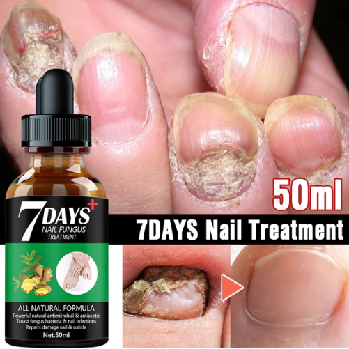 Herbal Nail Care Serum for Healthy Nails – Hand & Foot Care Formula