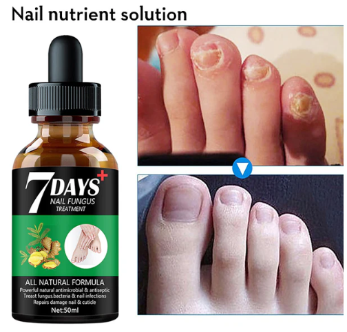 Herbal Nail Care Serum for Healthy Nails – Hand & Foot Care Formula